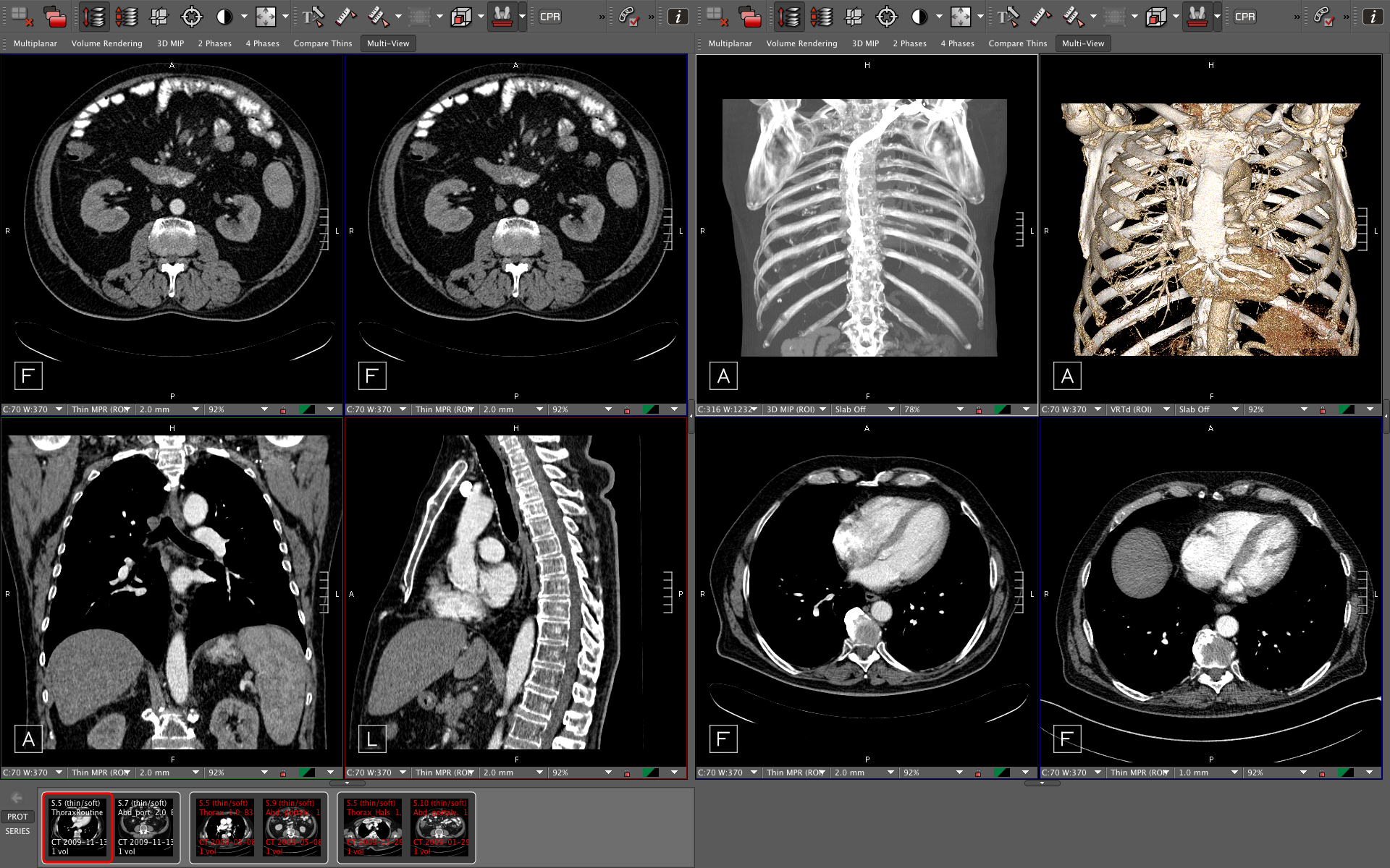 Visage Imaging Signs Pivotal Deal with vRad